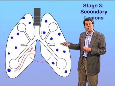 TB Dissemination - John McKinney (EPFL)