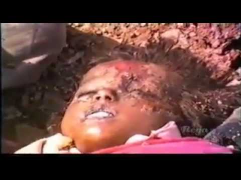 Halabja Massacre The halabja poison gas attack (Unpublished video)