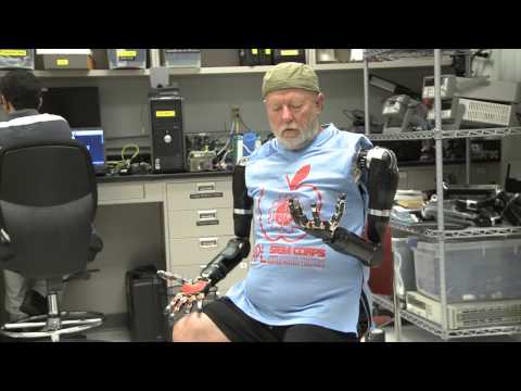 Amputee Makes History with APL’s Modular Prosthetic Limb