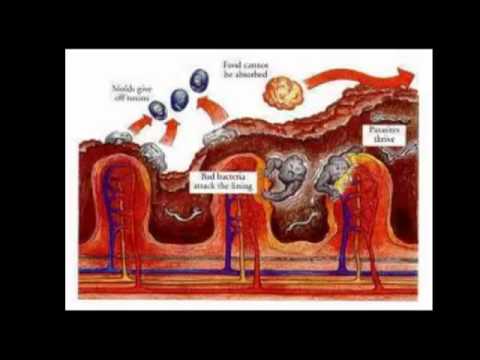 Food Grade Diatomaceous Earth