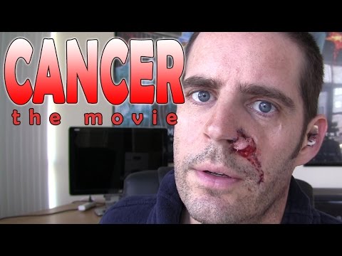 Cancer : The Movie - My Experiences With Basal Cell Carcinoma