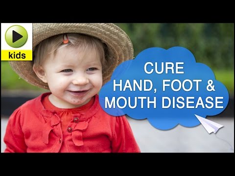 Kids Health: Hand, Foot and Mouth Disease- Natural Home Remedies for Hand,Foot and Mouth Disease