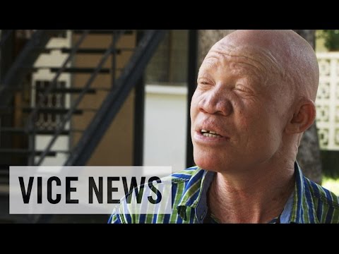 Albino Activism in Tanzania: VICE News Meets Josephat Torner