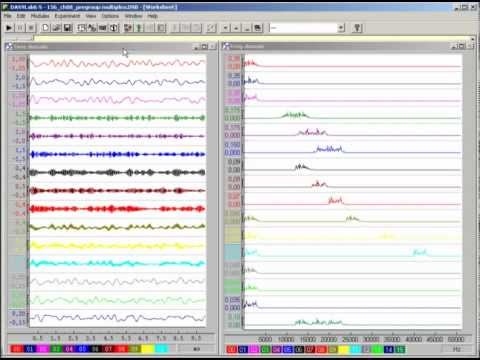 Signal Processing chapter 08 Classical modulation