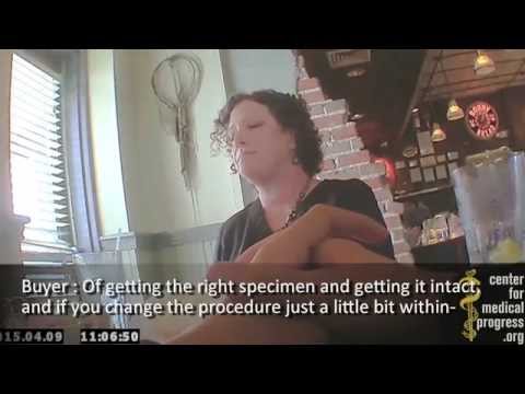 Intact Fetuses "Just a Matter of Line Items" for Planned Parenthood TX Mega-Center