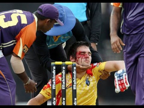 "BRUTAL" Injuries In Cricket History!!!