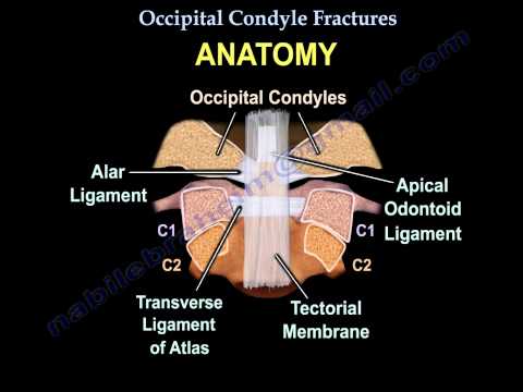 Occipital Condyle Fractures - Everything You Need To Know - Dr. Nabil Ebraheim