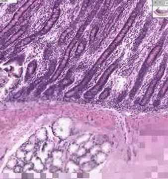 Shotgun Histology Duodenum