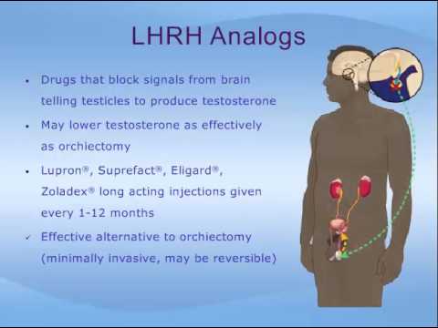 Hormone Therapy for Prostate Cancer