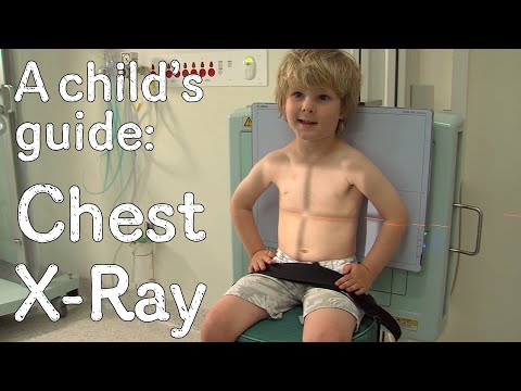 Having a chest X-ray