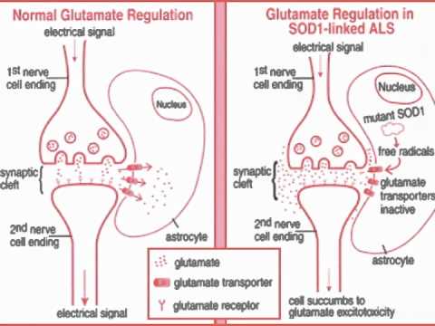 Amyotrophic Lateral Sclerosis