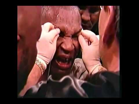 All Mike Tyson knockout losses