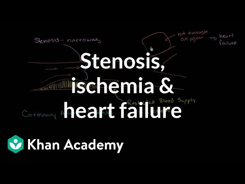 Stenosis, ischemia and heart failure