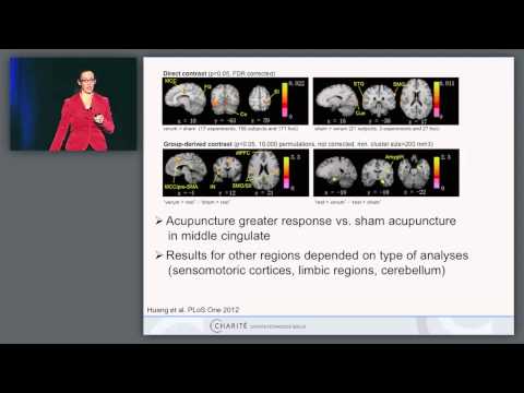 Neuroimaging and Stimulation Studies