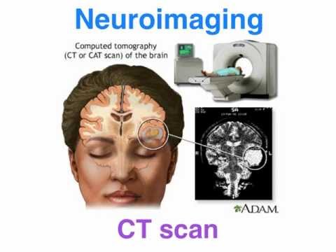 CT vs MRI - structural neuroimaging