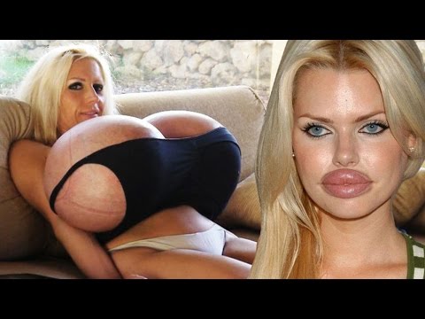 Top 10 Extreme Plastic Surgery Disasters