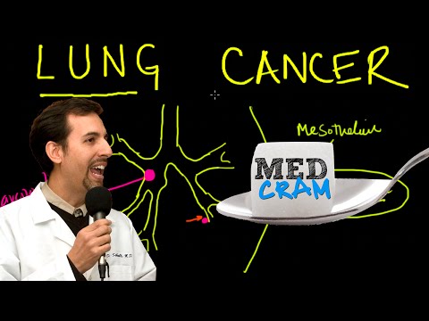 Lung Cancer Explained Clearly