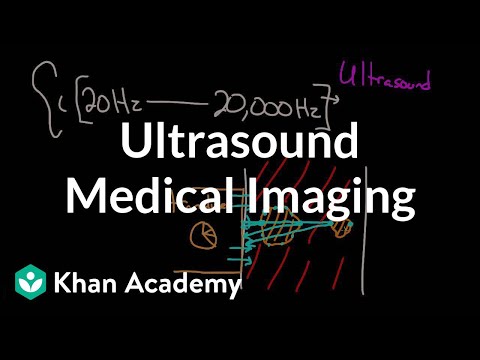 Ultrasound medical imaging