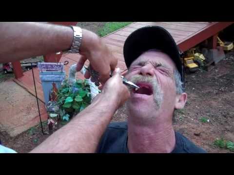 Redneck Dentist: East Texas tooth pulling