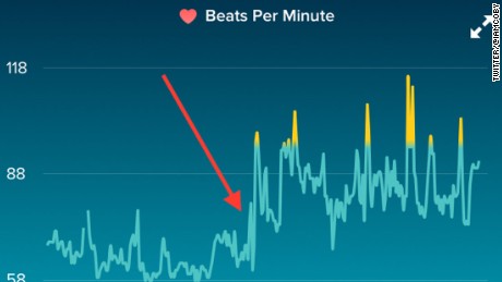 Israeli entrepreneur and law student Koby Soto tweeted a snap of his heart rate on the day he was unexpectedly dumped. 