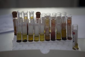 A blood samples from pregnant women wait to be analyzed for the presence of the Zika virus, at Guatemalan Social Security maternity hospital in Guatemala City, Tuesday, Feb. 2, 2016.