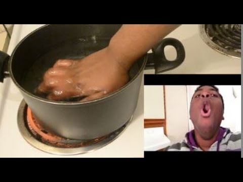 Hand In Boiling Water Challenge! HOOOT!