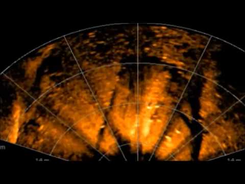 Baltic sea Anomaly take five updated 2014 HD