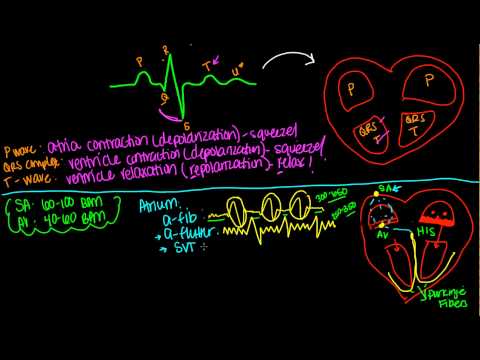 EKG or ECG- Simple Simple!