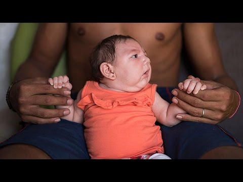 Should You Be Worried About The Zika Virus?