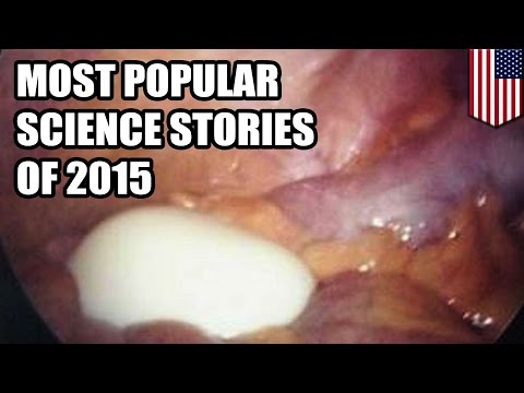 Science compilation: Egg stuck in man’s bladder - Most popular science stories of 2015 - TomoNews