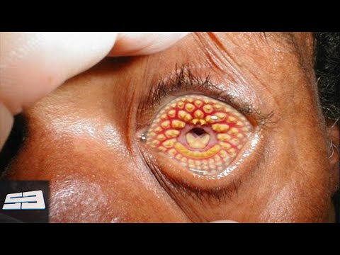 10 Diseases That Kill You in 24 Hours