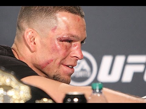 Nate Diaz Suffered Cabo Trip and Mexican Water Going Into Conor McGregor Fight  (UFC 196 Post)