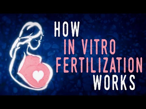 How in vitro fertilization (IVF) works - Nassim Assefi and Brian A. Levine