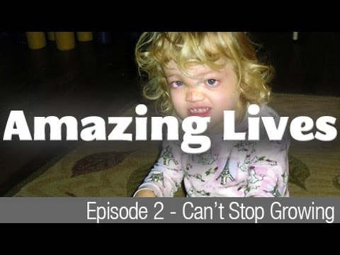 Amazing Lives - Can't Stop Growing - 4 year old girl suffering from Proteus Syndrome