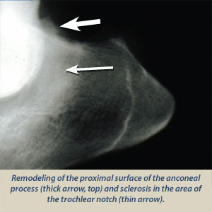 Elbow Dysplasia