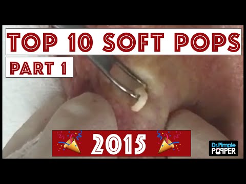 My Top 10 BEST Blackhead Pops of 2015: Part 1, #4-#10