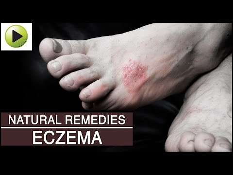 Skin Care - Eczema - Natural Ayurvedic Home Remedies