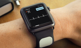 Kardia ECG Band for Apple Watch Unveiled