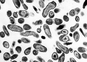 This November 2002 image provided by the Rocky Mountain Laboratories/National Institute of Allergy and Infectious Diseases shows Coxiella burnetii bacteria which causes Q fever in humans.