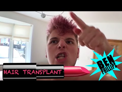 Ben Phillips | Hair Transplant PRANK - Elliot's finally come out