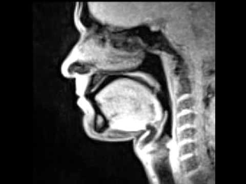 Vocal tract – Real time MRI