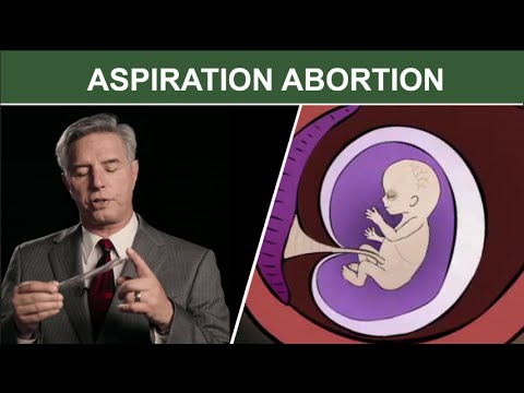 1st Trimester Surgical Abortion: Aspiration (Suction) D & C