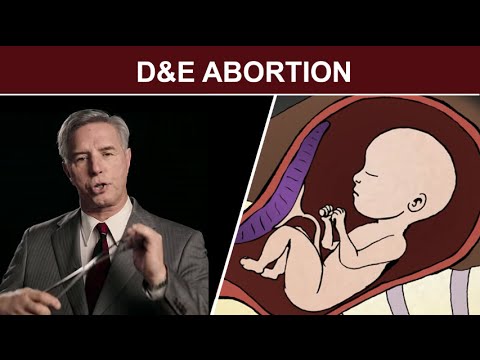 2nd Trimester Surgical Abortion: Dilation and Evacuation (D & E)