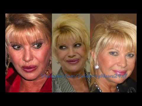 Ivana Trump Plastic Surgery Before and After Full HD