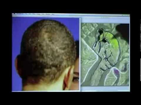 Barack Hussein Obama (Cloned DNA / Annunaki) part 1