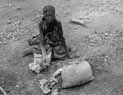 Starvation, while a UN report says that we can produce enough food for ten times the world's population.