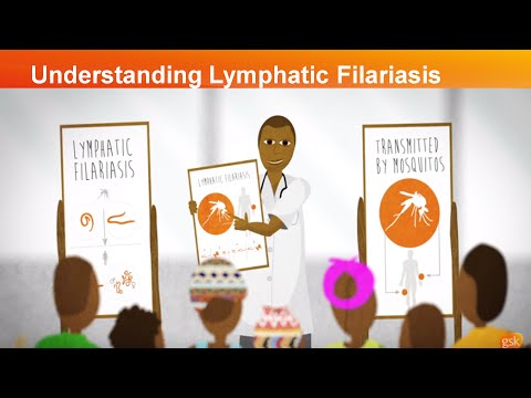 Patient Story - Understanding Lymphatic Filariasis