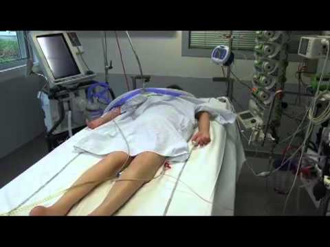 Prone Positioning in Severe Acute Respiratory Distress Syndrome