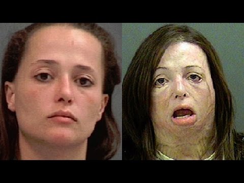 Top 10 Shocking Before And After Drug Use Photos