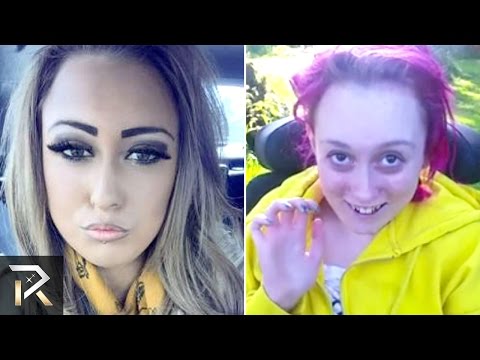 Shocking Before-And-After Drug Use Photos